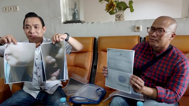 Korban penganiaayaan, Amiruddin Malik dan kuasa hukum saat memperlihatkan sejumlah bukti dugaan penganiayaan. Foto: Portalmedia/Reza