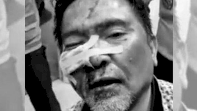 Pembuat Onar di Dalam Pesawat Turkish Airline Ternyata Pilot Batik Air, Diamankan dengan Wajah Babak Belur