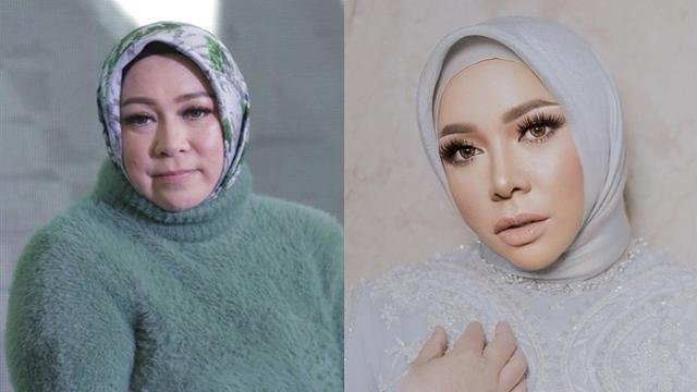 Operasi Bariatrik Bikin Melly Goeslaw Berhenti Merokok