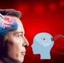 Elon Musk Siap Uji Coba Pasang Chip ke Otak Manusia, Diklaim Sembuhkan Kelumpuhan