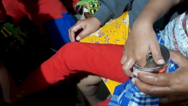 jari seorang bocah terjepit kaleng susu (IG)