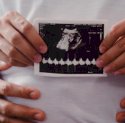Kisah Pejuang Dua Garis Biru: Menapaki Jejak Medis, Mendobrak Kebiasaan, Lalu Memilih Program Bayi Tabung