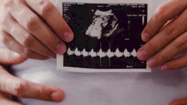 Kisah Pejuang Dua Garis Biru: Menapaki Jejak Medis, Mendobrak Kebiasaan, Lalu Memilih Program Bayi Tabung