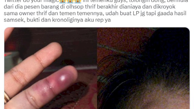 Kasus Owner Olshop Aniaya Pembelinya, Berawal Korban Minta Refund Karena Barang Tak Dikirim