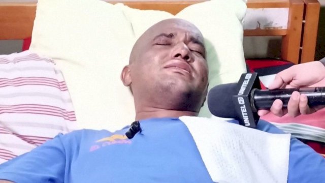 Jhonattan Acosta (30), seorang pria asal Bolivia ditemukan setelah tersesat dalam hutan Amazon selama 31 hari. (foto: SS BBC)