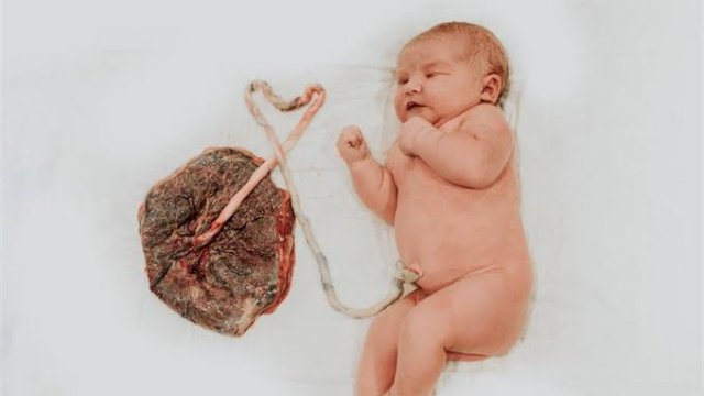 Viral! Aktor di Taiwan Makan Plasenta Bayinya, Ini Penjelasan Dokter  