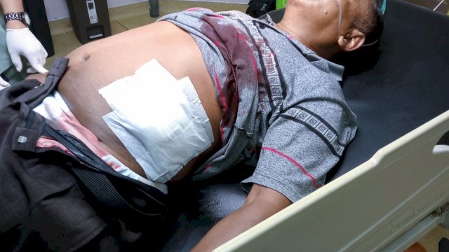 Pengawal Paslon Bupati Bantaeng Ditikam OTK