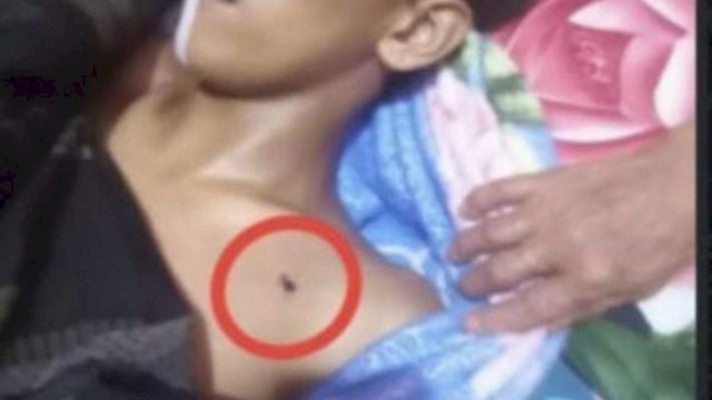 Seorang pelajar berusia 16 tahun berinisial MH tewas diduga akibat tertembak senapan angin.